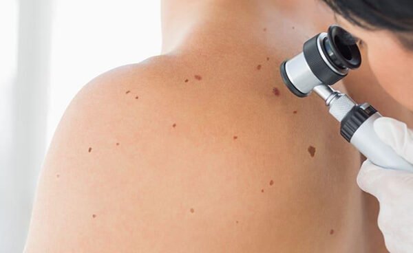 What Is a Full Body Skin Check and Why Does It Matter
