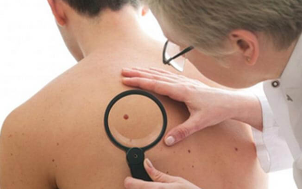 skin cancer treatment gold coast